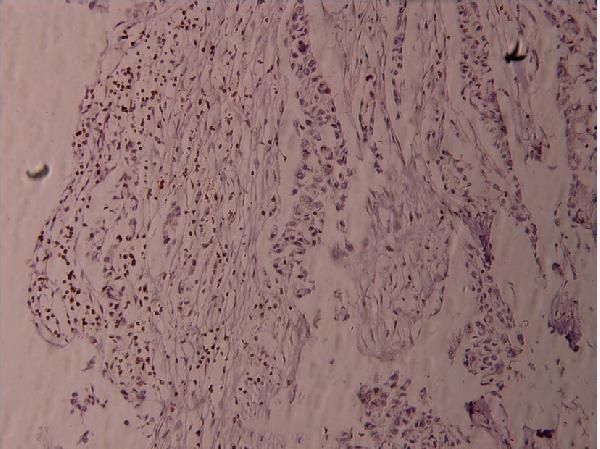 a00684y530 1 fyn primary antiboties ihc testing 2