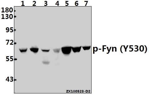 a00684y530 1 fyn primary antiboties wb testing 1