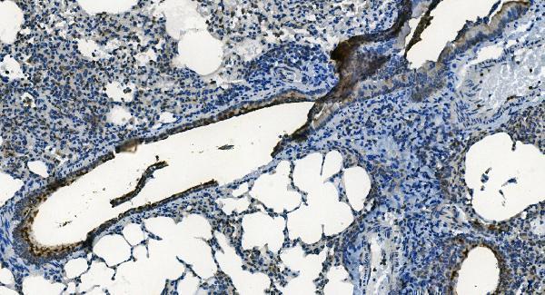 a00685 1 mcu primary antibodies ihc testing 2_1