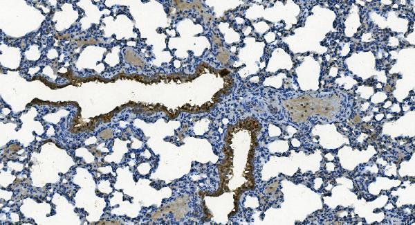 a00685 1 mcu primary antibodies ihc testing 3