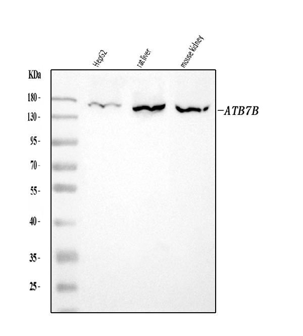 ATP7B Antibody