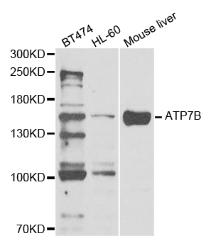 a00686 atp7b primary antiboties wb testing 1