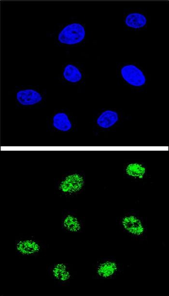 Confocal immunofluorescent analysis of TP73 Antibody (Center) with 293 cell followed by Alexa Fluor® 488-conjugated goat anti-rabbit lgG (green)
