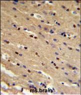 TP73 Antibody (Center) IHC analysis in formalin fixed and paraffin embedded mouse brain followed by peroxidase conjugation of the secondary antibody and DAB staining
