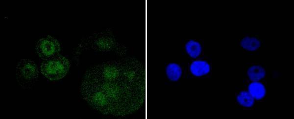 ICC staining p73 in MCF-7 cells (green)