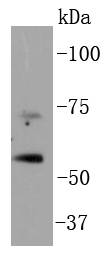 Western blot analysis of p73 on Hela cell lysates using anti-p73 antibody at 1/1,000 dilution