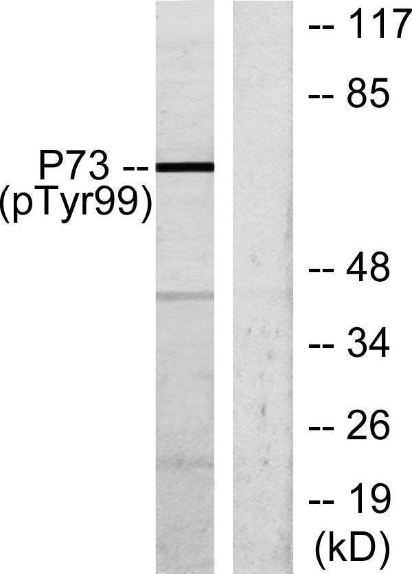 Western blot analysis of lysates from K562 cells treated with Pervanadate, using p73 (Phospho-Tyr99) Antibody