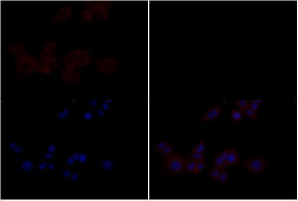 Immunofluorescence analysis of MCF-7 cells using EphB4 (E601) pAb at dilution of 1:200 (40x lens)