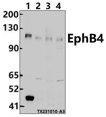 Western blot (WB) analysis of EphB4 (E601) polyclonal antibody at 1:500 dilution
Lane1:MCF-7 whole cell lysate(30ug)
Lane2:HepG2 whole cell lysate(30ug)
Lane3:3T3-L1 whole cell lysate(30ug)
Lane4:PC12 whole cell lysate(30ug)