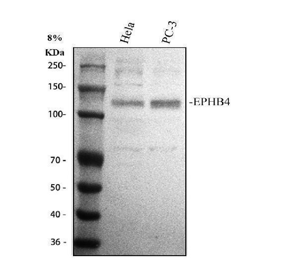  Western blot analysis of EPHB4 using anti-EPHB4 antibody (A00690-3)