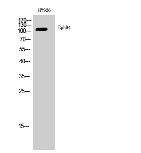 Western Blot analysis of HY926 cells using EphB4 Polyclonal Antibody diluted at 1:2000