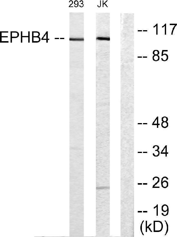 Western blot analysis of lysates from Jurkat and 293 cells, using EPHB4 Antibody