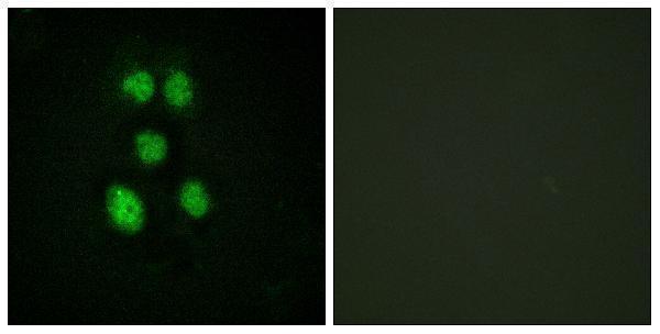 Immunofluorescence analysis of HeLa cells, using VAV1 Antibody