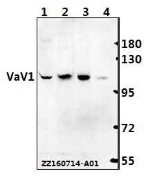 Western blot (WB) analysis of VaV1 (A168) polyclonal antibody at 1:500 dilution
Lane1:Hela whole cell lysate(40ug)
Lane2:Jurkat whole cell lysate(40ug)
Lane3:The spleen tissue lysate of Mouse(40ug)
Lane4:The spleen tissue lysate of Rat(40ug)