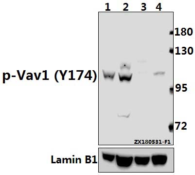 Western blot (WB) analysis of p-Vav1 (Y174) pAb at 1:500 dilution
Lane1:THP-1 whole cell lysate(40ug)
Lane2:HuT78 whole cell lysate(40ug)
Lane3:The Spleen tissue lysate of Mouse(40ug)
Lane4:The Spleen tissue lysate of Rat(40ug)
