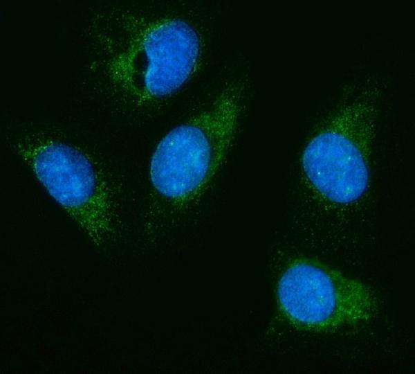  IF analysis of HEXA using anti-HEXA antibody (A00692-1)