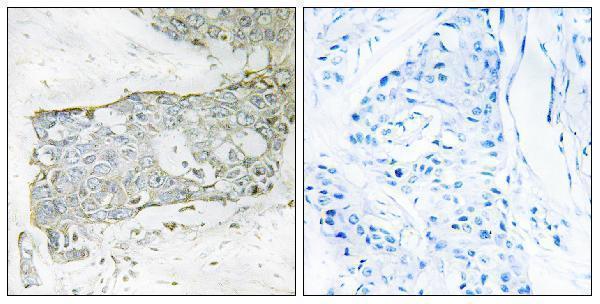 a00693 1 f7 primary antibodies ihc testing 1