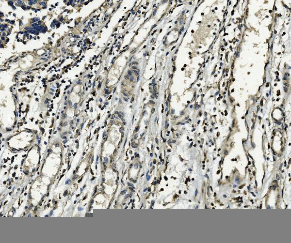  IHC analysis of XPD/ERCC2 using anti-XPD/ERCC2 antibody (A00694-2)
