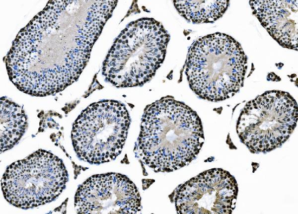 IHC analysis of XPD/ERCC2 using anti-XPD/ERCC2 antibody (A00694-2)