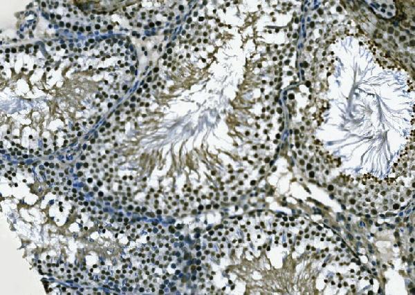a00694 2 ercc2 primary antibodies ihc testing 4
