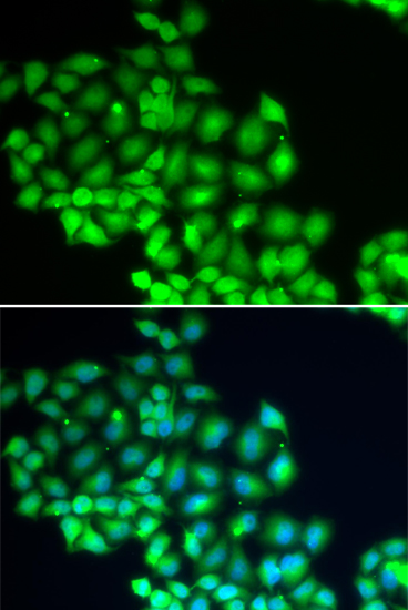 Immunofluorescence analysis of HeLa cells using XPD/XPD/ERCC2 antibody 