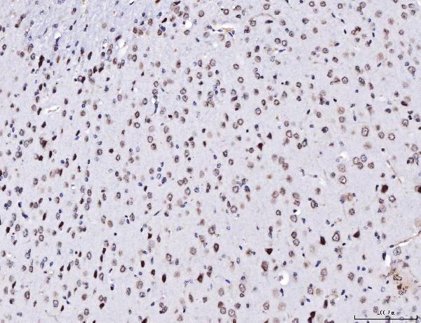  IHC analysis of TPR using anti-TPR antibody (A00695-2)
