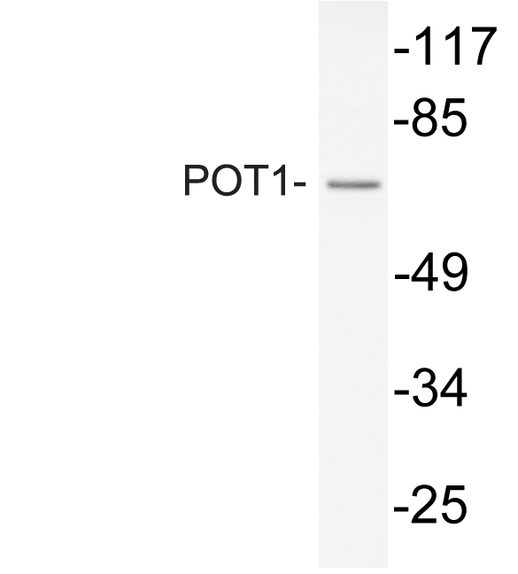 Western blot analysis of lysate from COS7 cells, using POT1 antibody