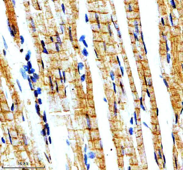 IHC analysis of MYH7-Specific using anti-MYH7-Specific antibody (A00697)