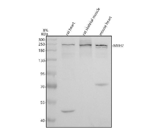 Western blot analysis of MYH7-Specific using anti-MYH7-Specific antibody (A00697)