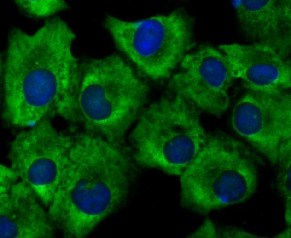 ICC staining Growth hormone receptor in A549 cells (green)