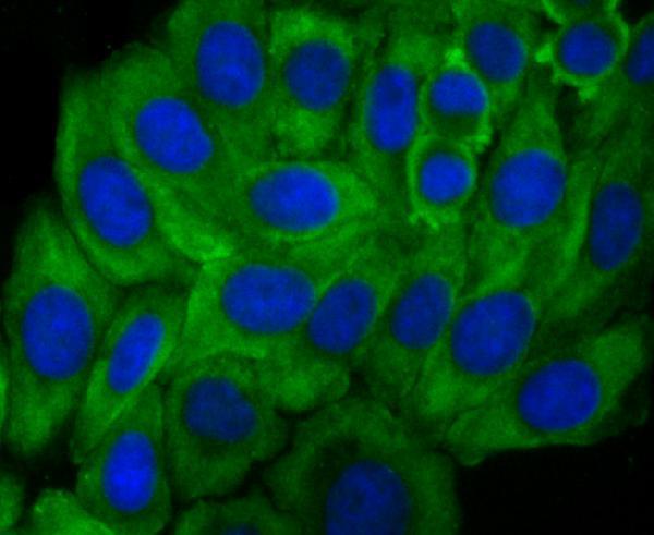 ICC staining Growth hormone receptor in HepG2 cells (green)