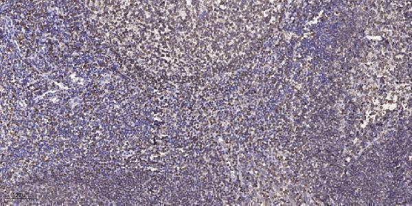 a00699 2 prkar1a primary antibodies ihc testing 1