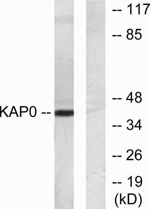 a00699 2 prkar1a primary antibodies wb testing 3
