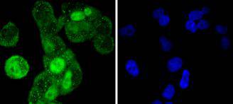 ICC staining Cyclin A2 in Hela cells (green)