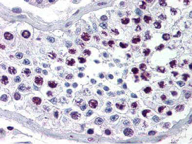 Immunohistochemistry of Rabbit Anti-Cyclin A antibody