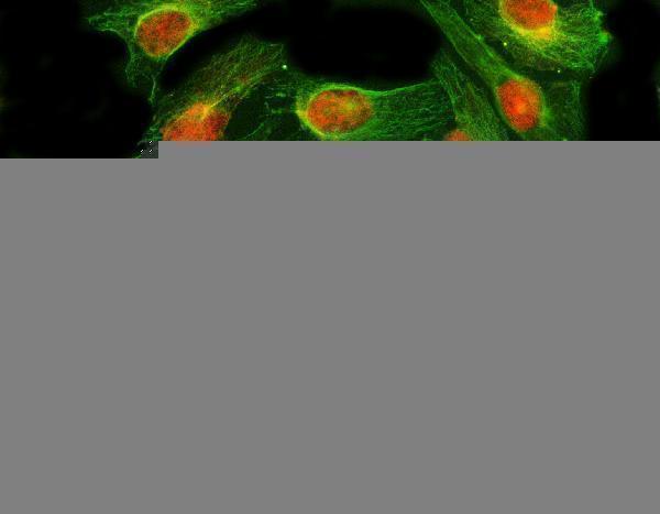 a00701 6 gli2 primary antibodies if testing 5