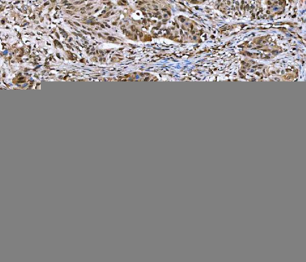  IHC analysis of GLI2 using anti-GLI2 antibody (A00701-6)