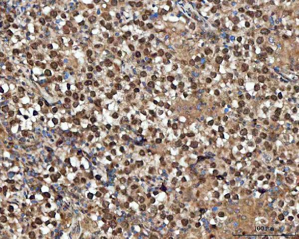  IHC analysis of GLI2 using anti-GLI2 antibody (A00701-6)