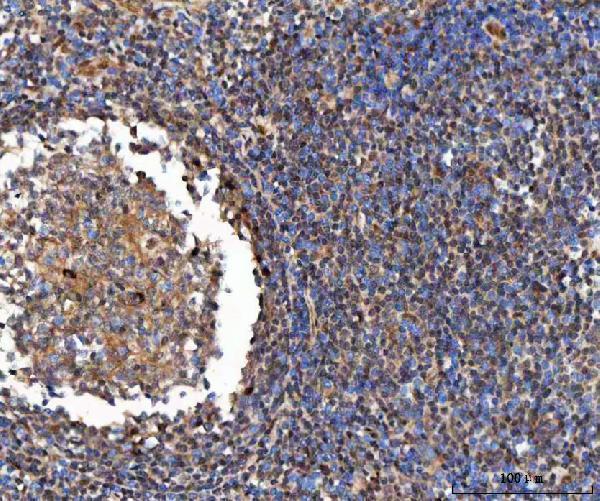 a00701 6 gli2 primary antibodies ihc testing 4