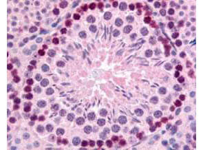 Boster's Affinity Purified anti-mouse Gli-2 antibody was used at 10 µg/ml to evaluate staining on several mouse tissues