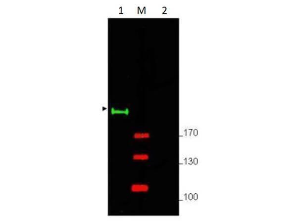 Western blot using Boster