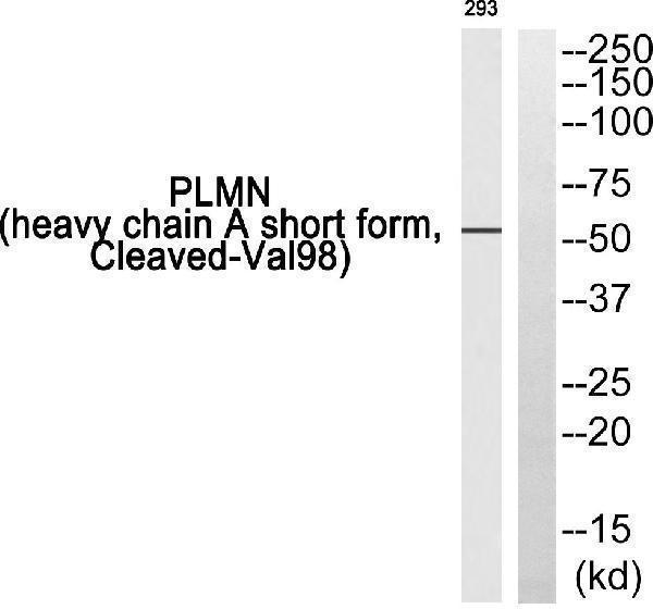 Western blot analysis of PLMN (heavy chain A short form, Cleaved-Val98) Antibody