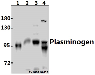 Western blot (WB) analysis of Plasminogen (Y233) pAb at 1:500 dilution
Lane1:L02 whole cell lysate(10ug)
Lane2:The Testis tissue lysate of Mouse(40ug)
Lane3:The Testis tissue lysate of Rat(40ug)
Lane4:K562 whole cell lysate(20ug)