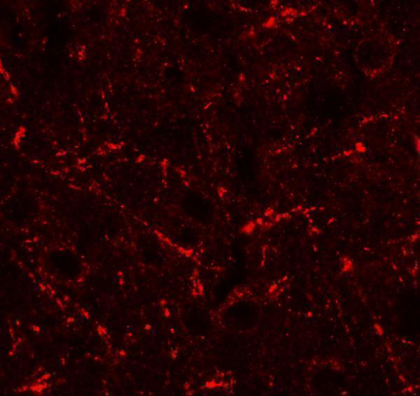 Immunofluorescence of CCL4 in rat brain tissue with CCL4 antibody at 20 μg/ml