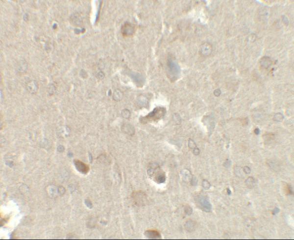 Immunohistochemistry of CCL4 in rat brain tissue with CCL4 antibody at 2