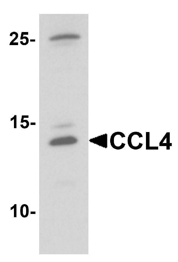 Western blot analysis of CCL4 in rat brain tissue lysate with CCL4 antibody at 1 μg/mL