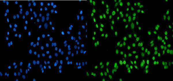 a00705 1 ssb primary antibodies if testing 7