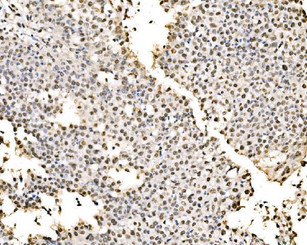  IHC analysis of SSB using anti-SSB antibody (A00705-1)
