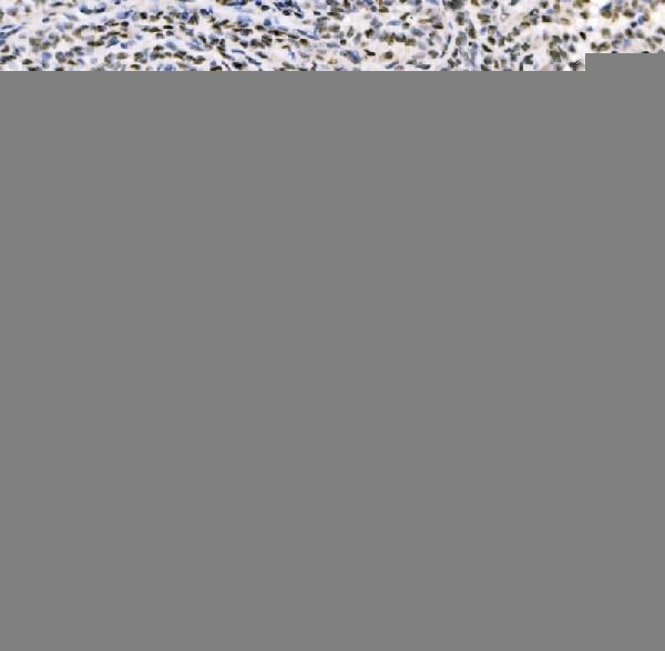  IHC analysis of SSB using anti-SSB antibody (A00705-1)