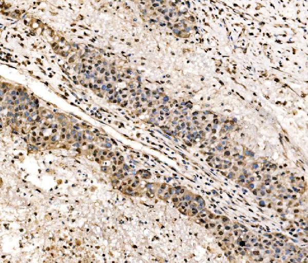 a00705 1 ssb primary antibodies ihc testing 4